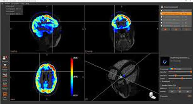 Multi-modal Imaging for Neurological Diagnostics (MIND)